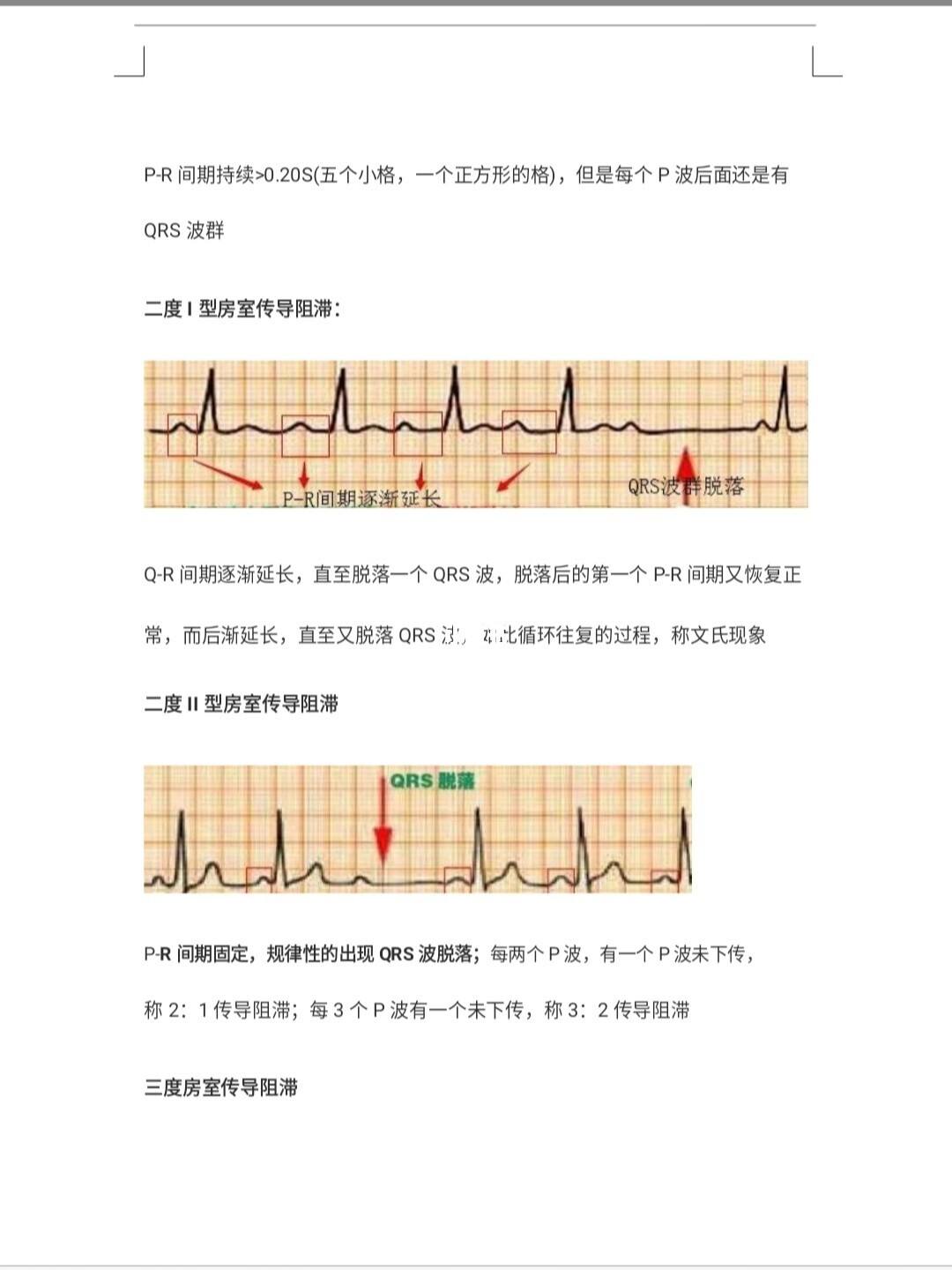 看心电图的七个步调(看懂心电图的十大口诀)