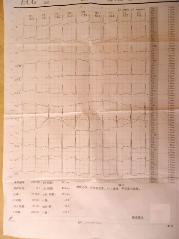 怎么看心电图(怎么看心电图陈述参数)